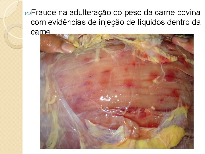  Fraude na adulteração do peso da carne bovina com evidências de injeção de