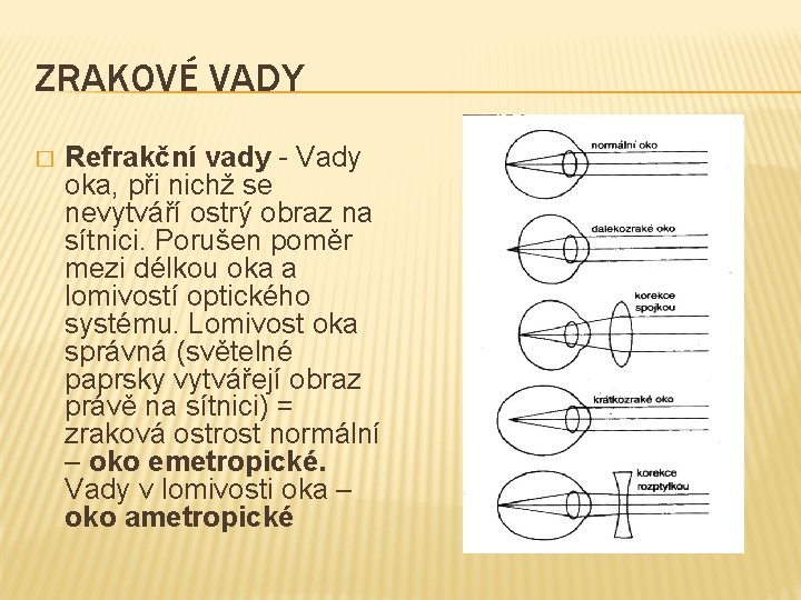 ZRAKOVÉ VADY � Refrakční vady - Vady oka, při nichž se nevytváří ostrý obraz