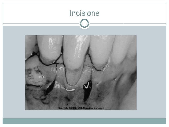 Incisions 