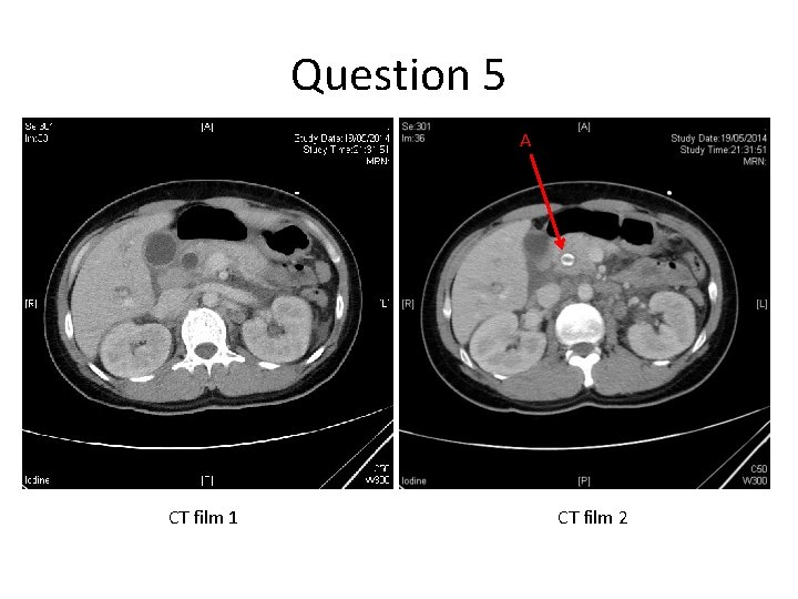 Question 5 A CT film 1 CT film 2 