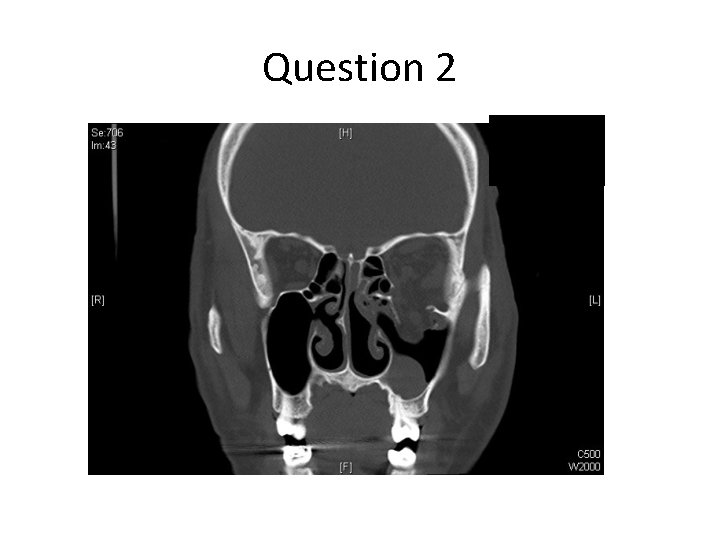 Question 2 