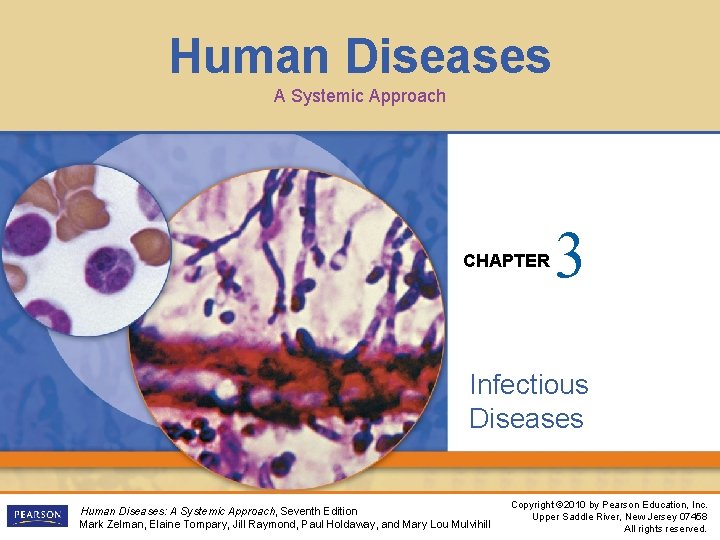 Human Diseases A Systemic Approach CHAPTER 3 Infectious Diseases Human Diseases: A Systemic Approach,