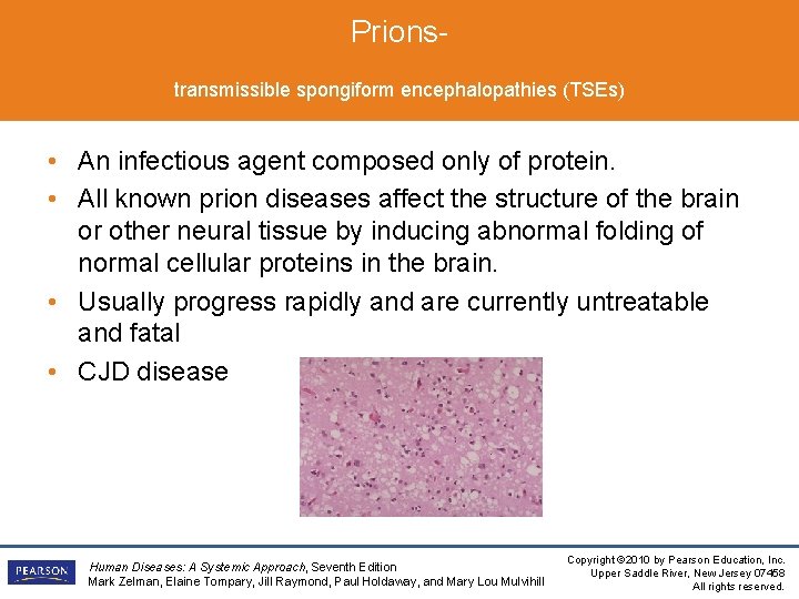 Prionstransmissible spongiform encephalopathies (TSEs) • An infectious agent composed only of protein. • All