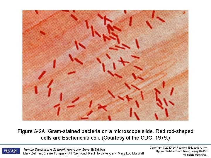 Figure 3 -2 A: Gram-stained bacteria on a microscope slide. Red rod-shaped cells are