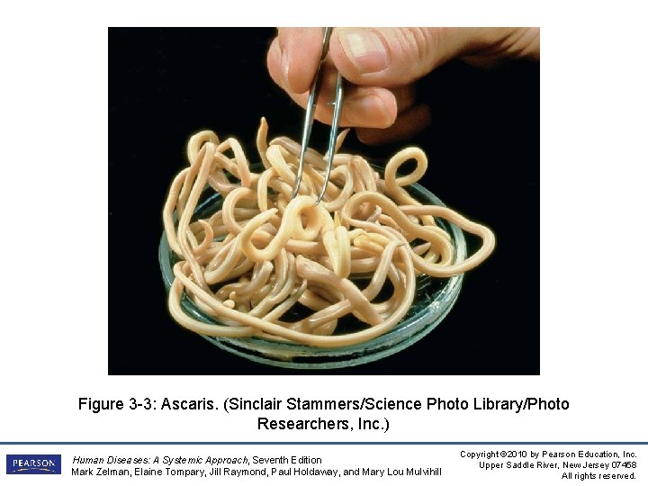 Figure 3 -3: Ascaris. (Sinclair Stammers/Science Photo Library/Photo Researchers, Inc. ) Human Diseases: A