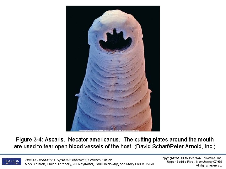 Figure 3 -4: Ascaris. Necator americanus. The cutting plates around the mouth are used