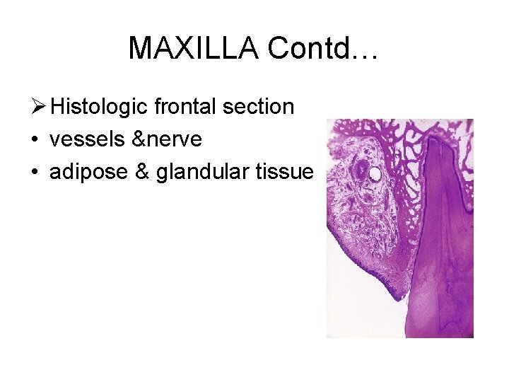 MAXILLA Contd… Ø Histologic frontal section • vessels &nerve • adipose & glandular tissue