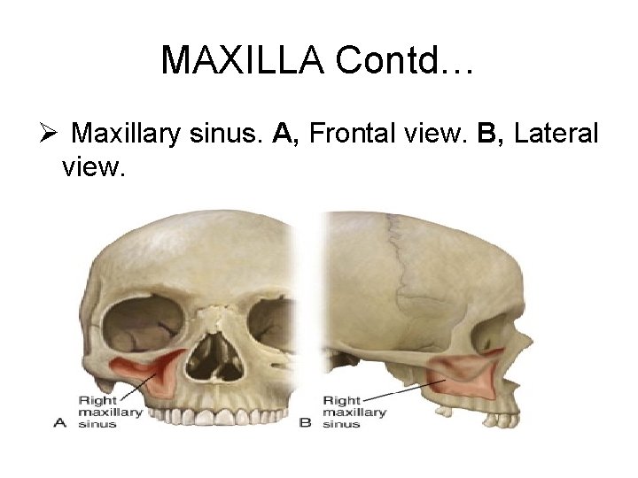 MAXILLA Contd… Ø Maxillary sinus. A, Frontal view. B, Lateral view. 