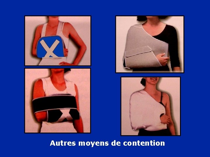 Autres moyens de contention 