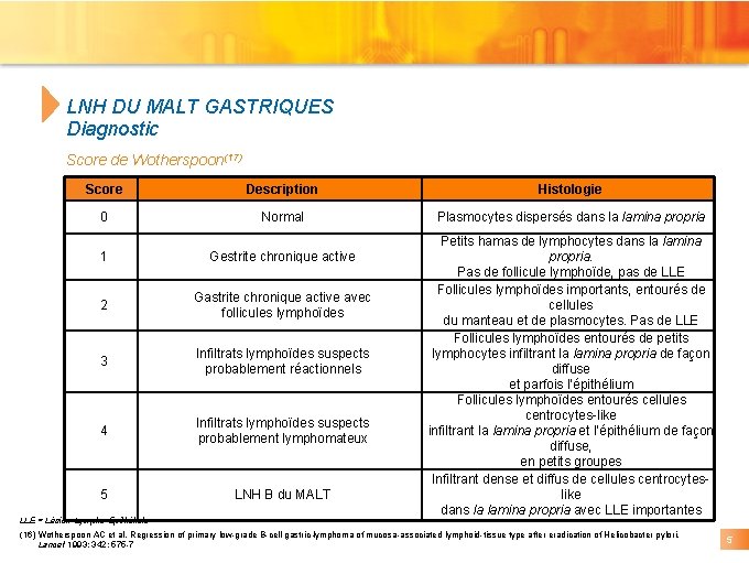 LNH DU MALT GASTRIQUES Diagnostic Score de Wotherspoon(17) Score Description Histologie 0 Normal Plasmocytes LNH DU MALT GASTRIQUES Diagnostic Score de Wotherspoon(17) Score Description Histologie 0 Normal Plasmocytes