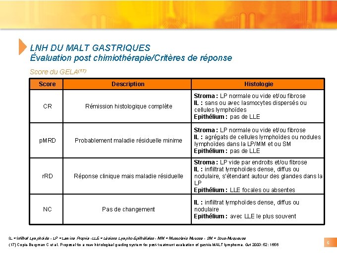 LNH DU MALT GASTRIQUES Évaluation post chimiothérapie/Critères de réponse Score du GELA(17) Score CR LNH DU MALT GASTRIQUES Évaluation post chimiothérapie/Critères de réponse Score du GELA(17) Score CR