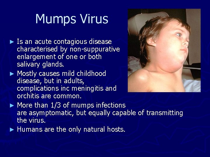 Mumps Virus Is an acute contagious disease characterised by non-suppurative enlargement of one or Mumps Virus Is an acute contagious disease characterised by non-suppurative enlargement of one or