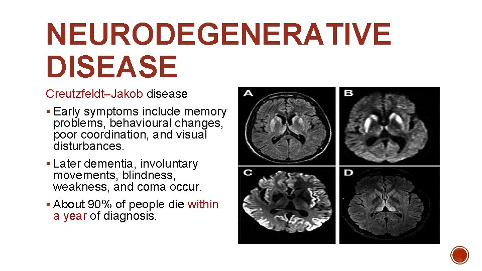 NEURODEGENERATIVE DISEASE Creutzfeldt–Jakob disease § Early symptoms include memory problems, behavioural changes, poor coordination,