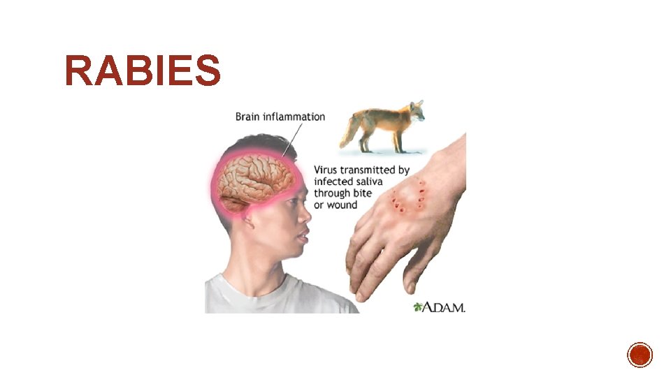 RABIES 