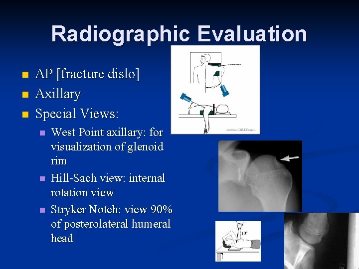 Radiographic Evaluation n AP [fracture dislo] Axillary Special Views: n n n West Point