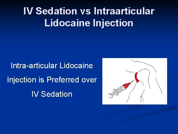 IV Sedation vs Intraarticular Lidocaine Injection Intra-articular Lidocaine Injection is Preferred over IV Sedation