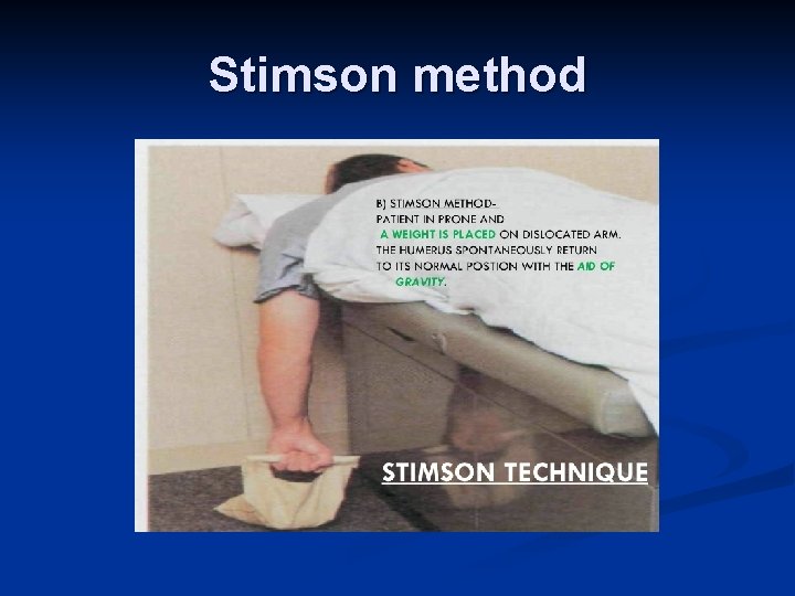 Stimson method 