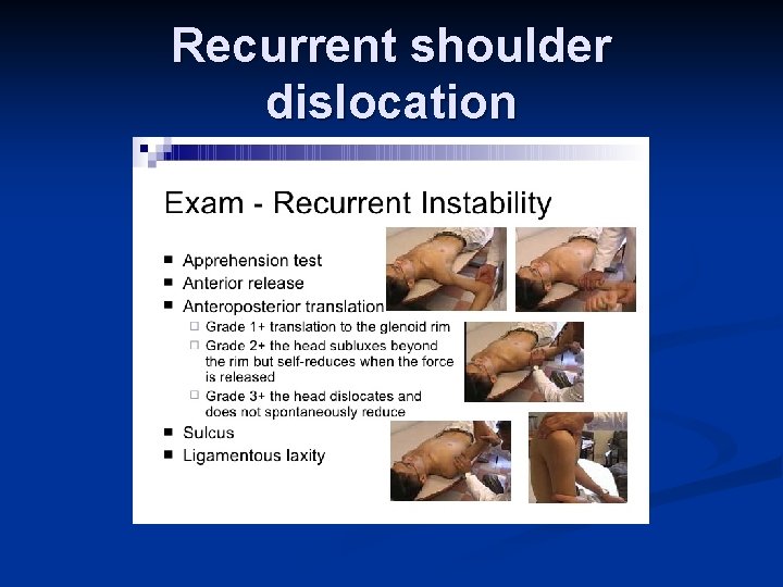 Recurrent shoulder dislocation 