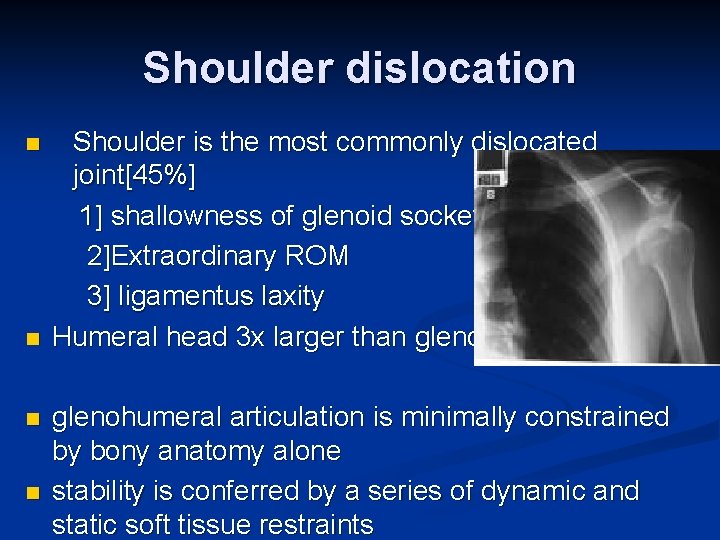 Shoulder dislocation n n Shoulder is the most commonly dislocated joint[45%] 1] shallowness of