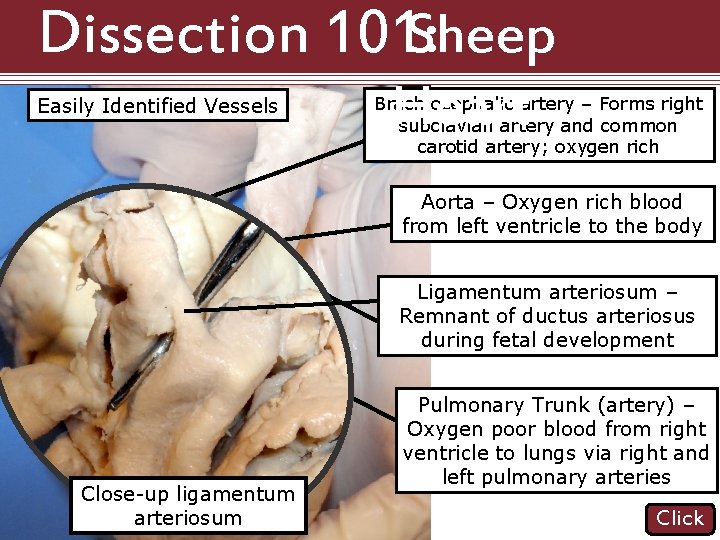 Dissection 101: Sheep Easily Identified Vessels Heart Brachiocephalic artery – Forms right subclavian artery