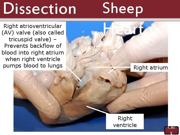 Dissection 101: Right atrioventricular (AV) valve (also called tricuspid valve) – Prevents backflow of