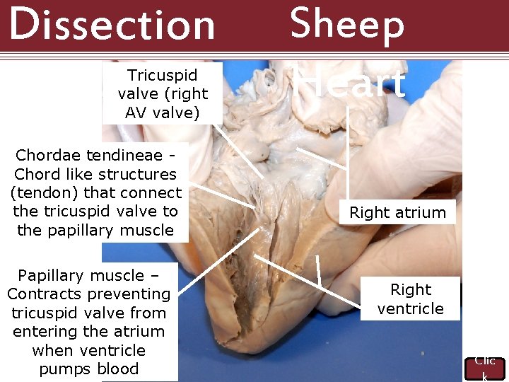 Dissection 101: Tricuspid valve (right AV valve) Chordae tendineae Chord like structures (tendon) that