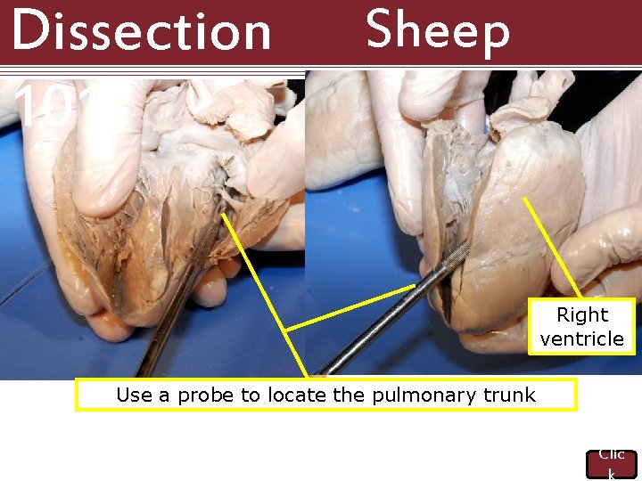 Dissection 101: Sheep Heart Right ventricle Use a probe to locate the pulmonary trunk