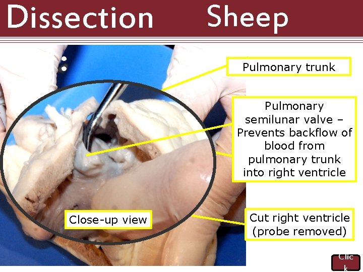 Dissection 101: Sheep Heart Pulmonary trunk Pulmonary semilunar valve – Prevents backflow of blood