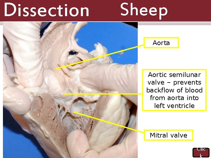 Dissection 101: Sheep Heart Aorta Aortic semilunar valve – prevents backflow of blood from