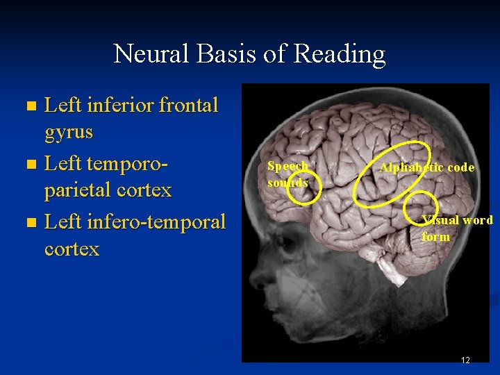 Neural Basis of Reading Left inferior frontal gyrus n Left temporoparietal cortex n Left