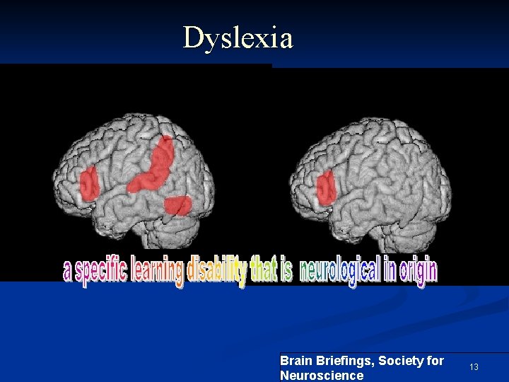 Dyslexia Brain Briefings, Society for Neuroscience 13 