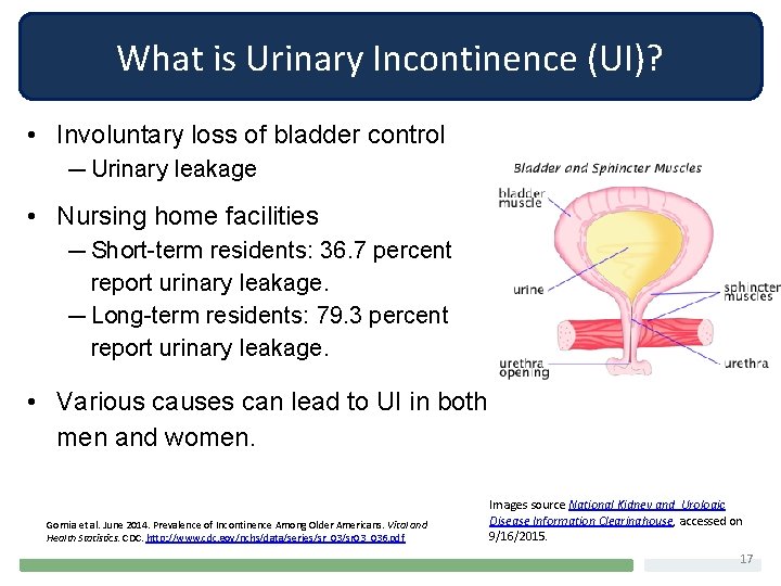 What is Urinary Incontinence (UI)? • Involuntary loss of bladder control — Urinary leakage