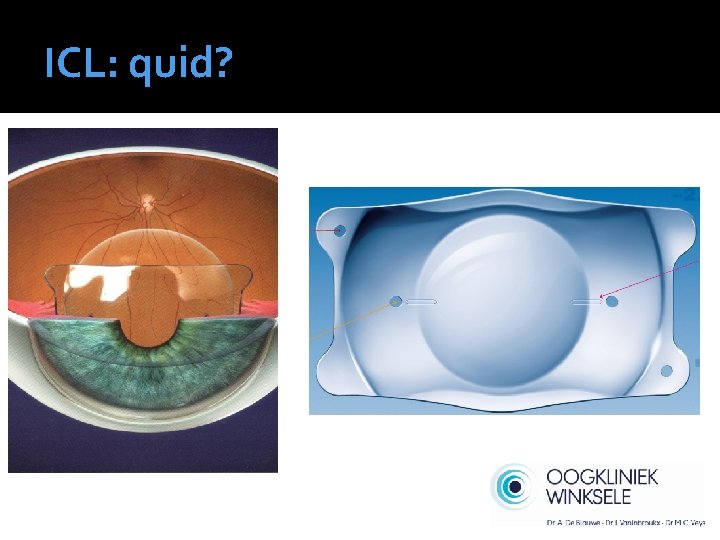 ICL: quid? 