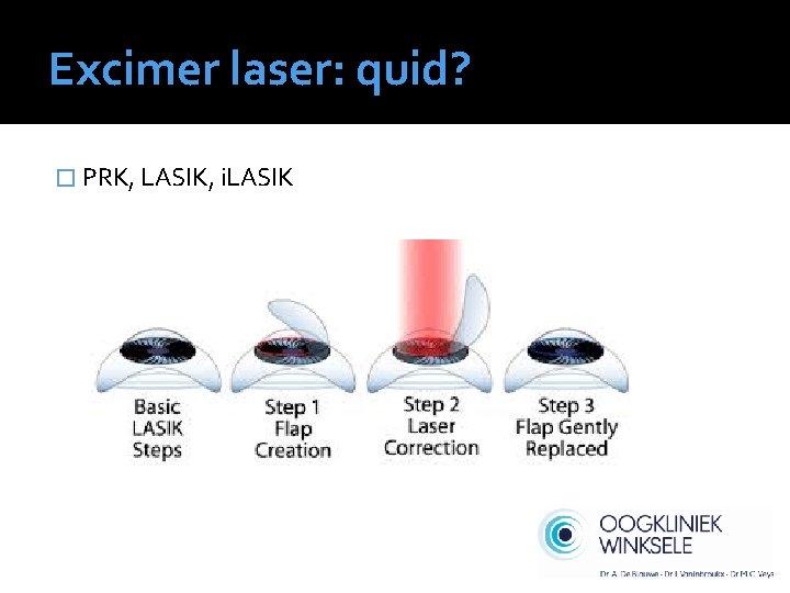 Excimer laser: quid? � PRK, LASIK, i. LASIK 