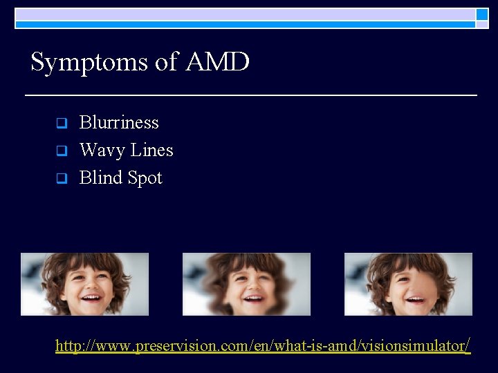 Symptoms of AMD q q q Blurriness Wavy Lines Blind Spot http: //www. preservision.