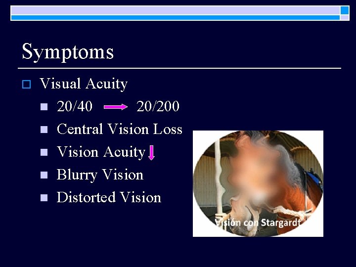 Symptoms o Visual Acuity n 20/40 20/200 n Central Vision Loss n Vision Acuity