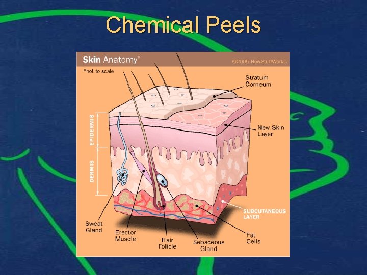 Chemical Peels 