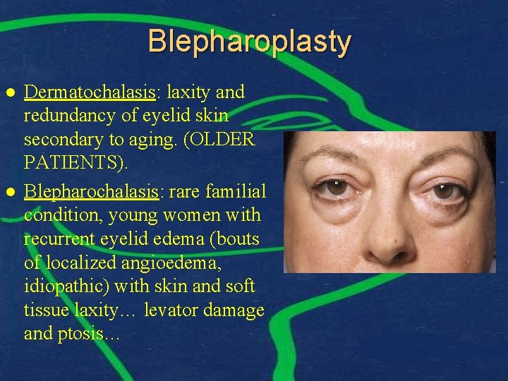 Blepharoplasty l l Dermatochalasis: laxity and redundancy of eyelid skin secondary to aging. (OLDER