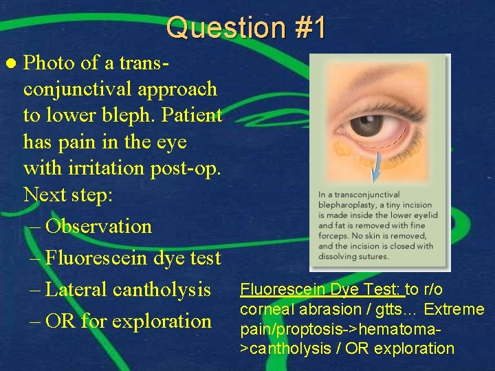 Question #1 l Photo of a transconjunctival approach to lower bleph. Patient has pain