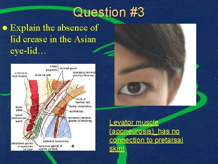 Question #3 l Explain the absence of lid crease in the Asian eye-lid… Levator