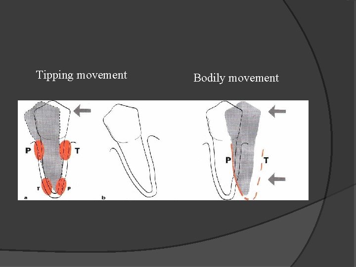 Tipping movement Bodily movement 