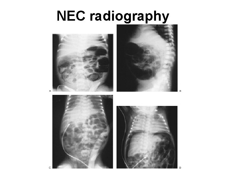 NEC radiography 