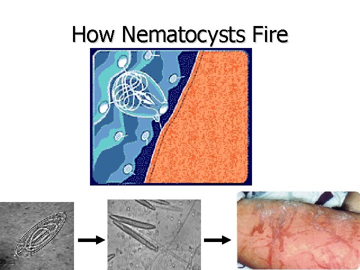 How Nematocysts Fire 