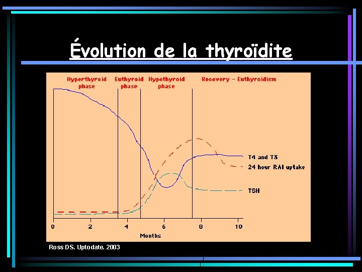 Évolution de la thyroïdite Ross DS. Uptodate. 2003 Évolution de la thyroïdite Ross DS. Uptodate. 2003