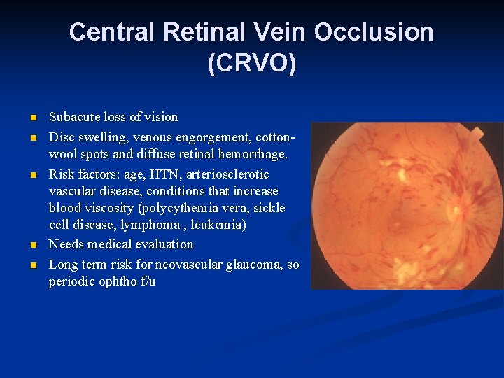 Central Retinal Vein Occlusion (CRVO) n n n Subacute loss of vision Disc swelling,