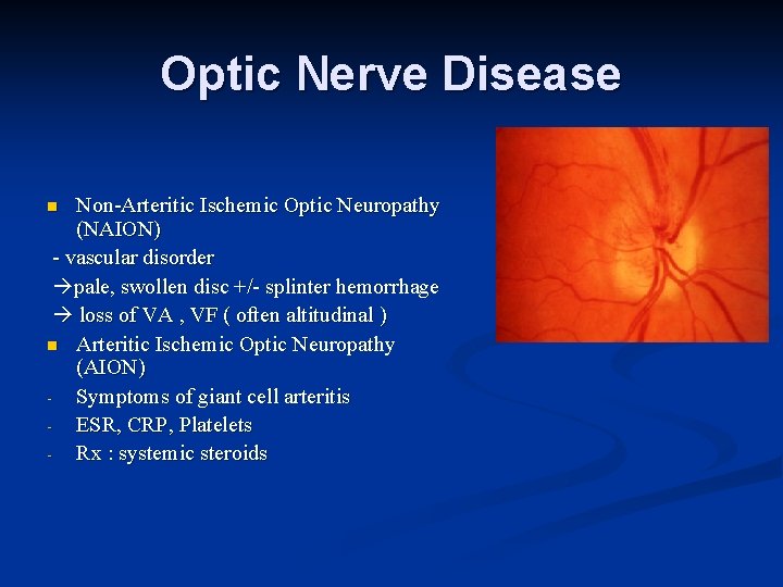 Optic Nerve Disease Non-Arteritic Ischemic Optic Neuropathy (NAION) - vascular disorder pale, swollen disc