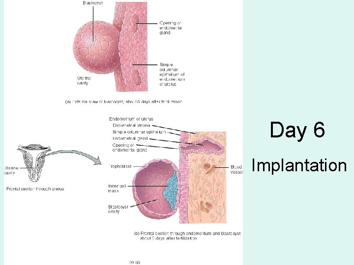 Day 6 Implantation 