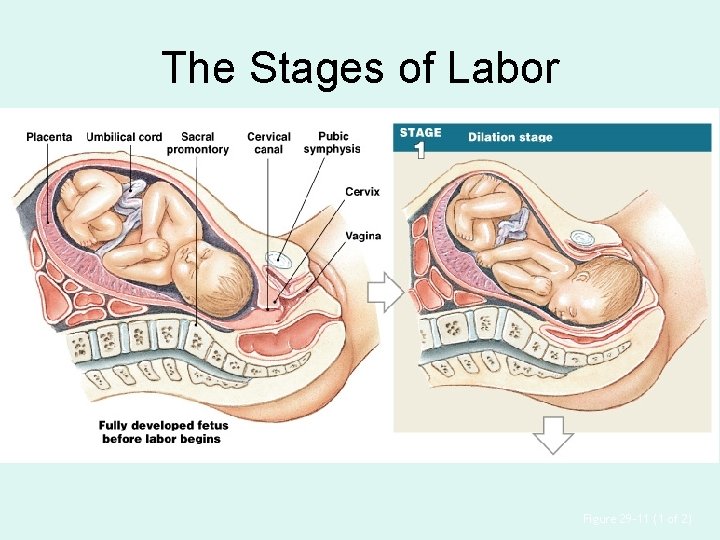 The Stages of Labor Figure 29– 11 (1 of 2) 