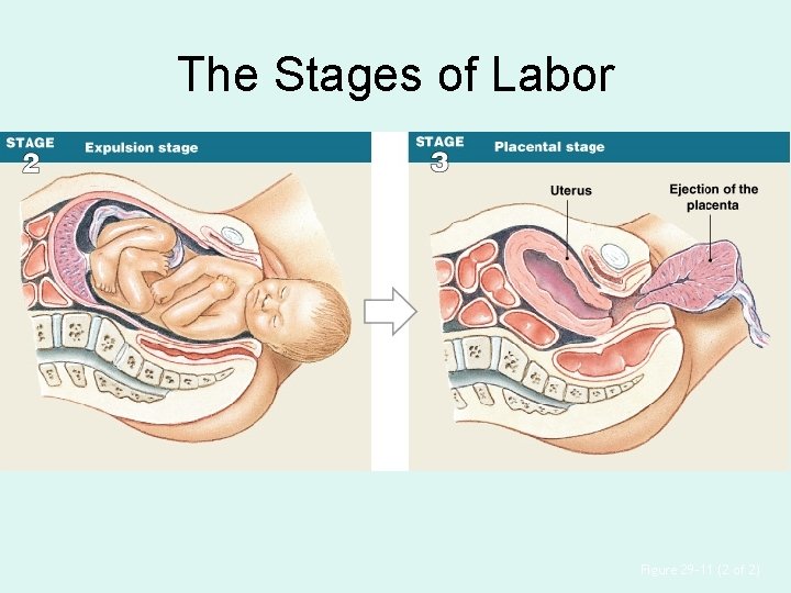 The Stages of Labor Figure 29– 11 (2 of 2) 