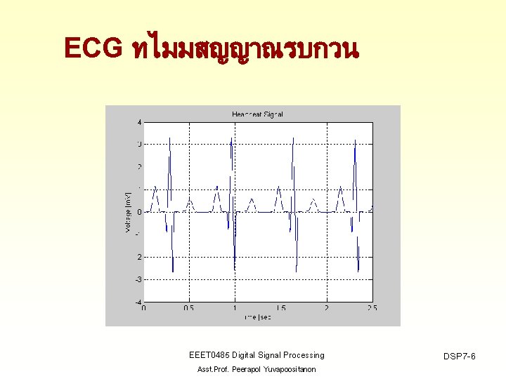ECG ทไมมสญญาณรบกวน EEET 0485 Digital Signal Processing Asst. Prof. Peerapol Yuvapoositanon DSP 7 -6
